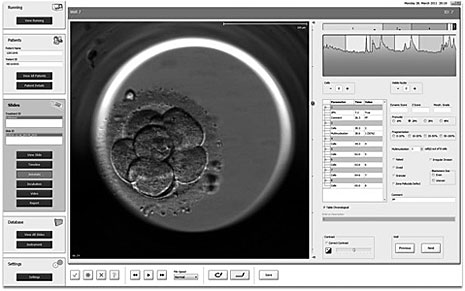 L’Embryoscope